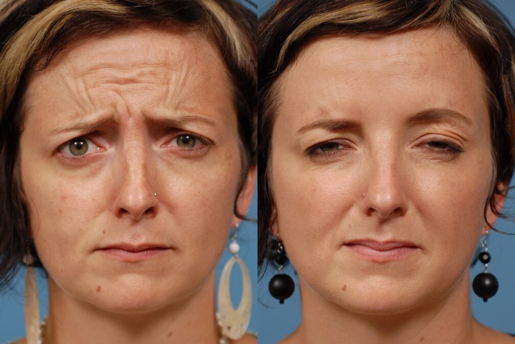 before and after using the rejuvenating massager ltza photo 2