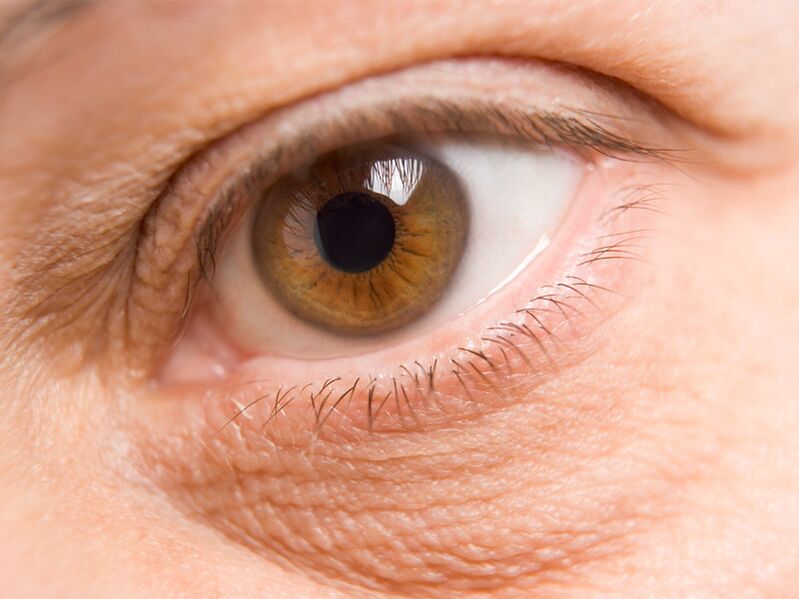 skin around the eyes and its laser rejuvenation